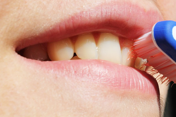 diş taşı temizliği zararları