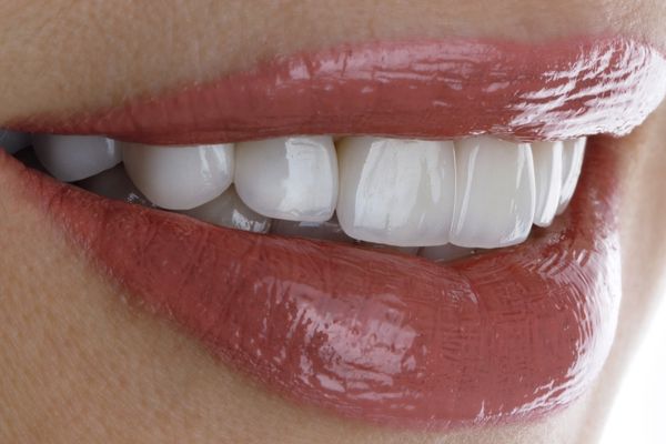 evde diş beyazlatma yöntemleri