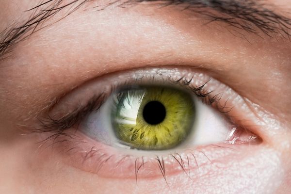 Göz Nezlesine İyi Gelen 7 Bitkisel Tedavi Yöntemi - Nefis Yemek Tarifleri
