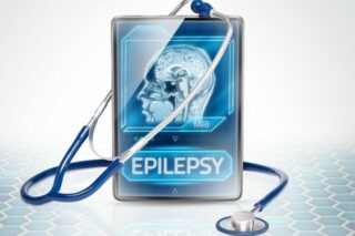 Epilepsi Hastalığı Nedir? Çeşitleri, Belirtileri ve Tedavisi Tarifi