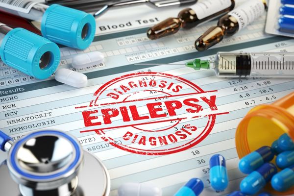 epilepsi tedavisi